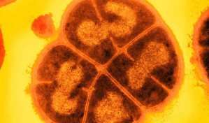Conan, la bacteria que soporta la radiaci&oacute;n extrema