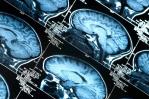 Descubren trece proteínas relacionadas con el envejecimiento cerebral en los humanos