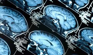 Descubren trece proteínas relacionadas con el envejecimiento cerebral en los humanos Descubren trece proteínas relacionadas con el envejecimiento cerebral en los humanos