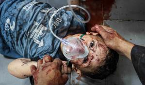 Cadáveres acumulados y hospitales sin cirujanos tras 75 días de ofensiva en norte Gaza