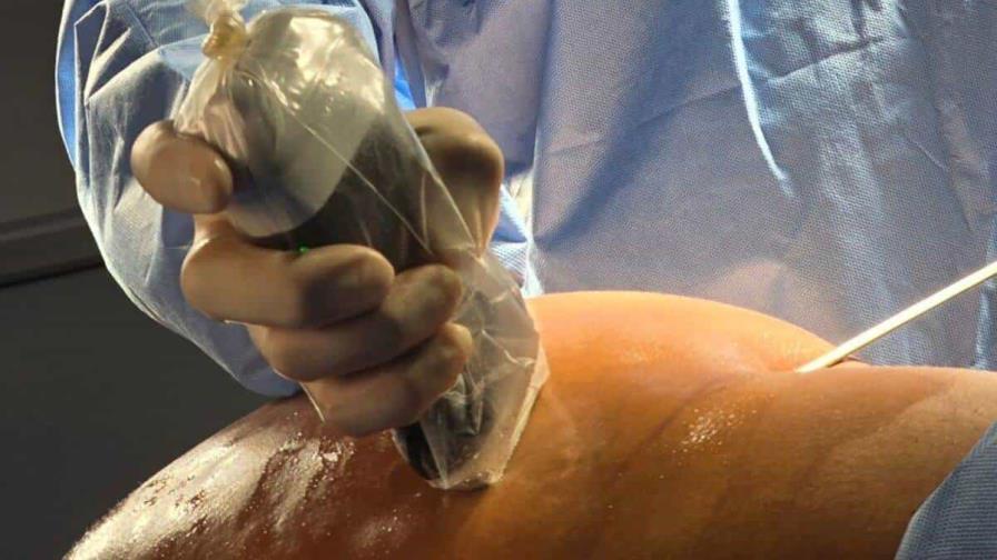 Lipotransferencia glútea es la cirugía plástica más demandada en el país, revela cirujano