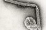 Los CDC detectan posible mutación del virus de la gripe aviar en un paciente de Luisiana Los CDC detectan posible mutación del virus de la gripe aviar en un paciente de Luisiana