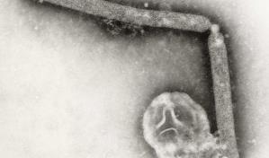 Los CDC detectan posible mutación del virus de la gripe aviar en un paciente de Luisiana