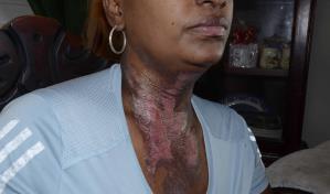 Víctima de intento de feminicidio a autoridades: ¿Qué están esperando, que termine lo que empezó?