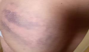 Defensa Pública reitera que cárcel El Pinito-La Vega debe ser intervenida por denuncias de abusos