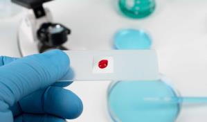 Salud Pública dice no hay situación de emergencia sobre el VIH y que cuenta con recursos propios