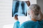 En lo que va de 2025, las autoridades sanitarias registran 302 casos de tuberculosis