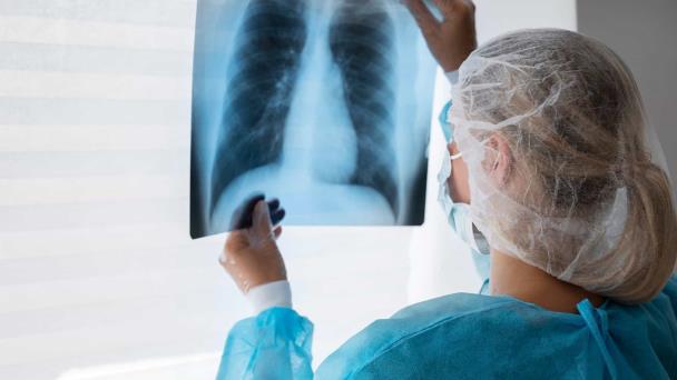 En lo que va de 2025, las autoridades sanitarias registran 302 casos de tuberculosis