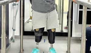 ITLA diseñará prótesis gratuitas para afectados en tragedia de Jet Set