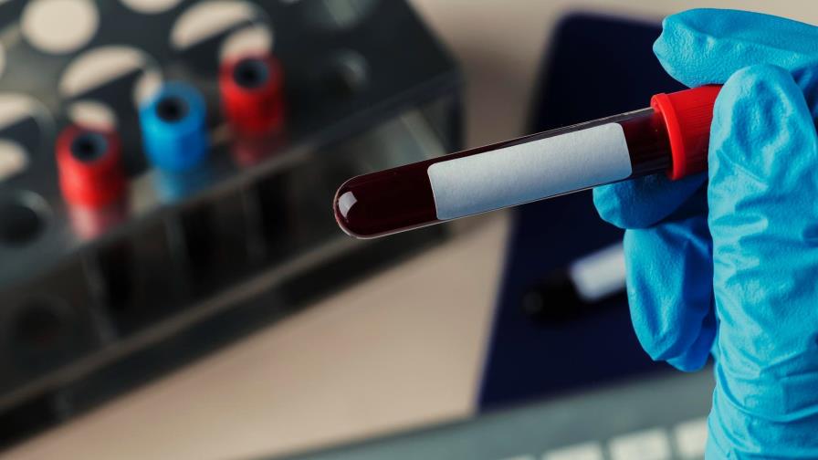 Hemofilia, enfermedad hereditaria que dificulta la coagulación de la sangre Hemofilia, enfermedad hereditaria que dificulta la coagulación de la sangre