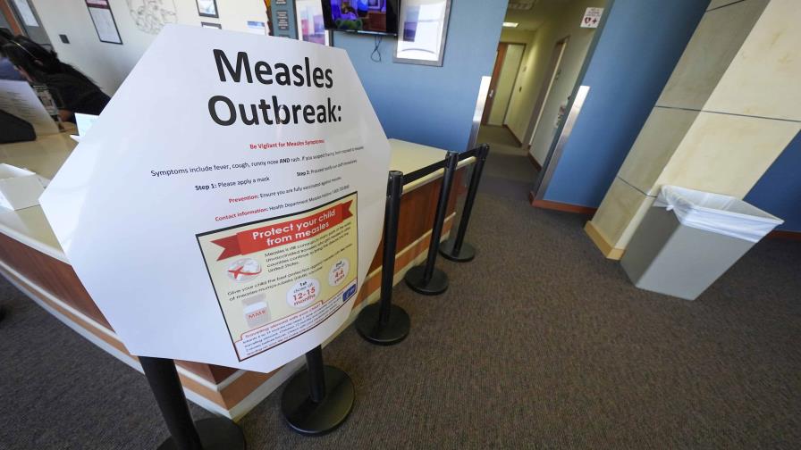 Estados Unidos registra 800 casos de sarampión; un resumen del brote por estados Estados Unidos registra 800 casos de sarampión; un resumen del brote por estados