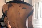 Atacan a madre e hija con ácido del diablo; acusan a hermanas de hombre denunciado por abuso sexual Atacan a madre e hija con ácido del diablo; acusan a hermanas de hombre denunciado por abuso sexual