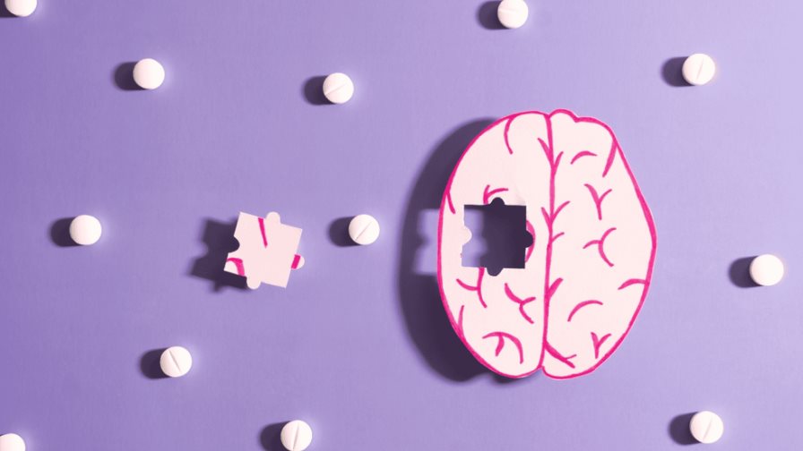 ¿Sabías que la vacuna para el Alzheimer podría estar en nuestro cerebro? ¿Sabías que la vacuna para el Alzheimer podría estar en nuestro cerebro?
