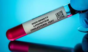 ¿Qué tan peligrosa es una lipoproteína (a) elevada?