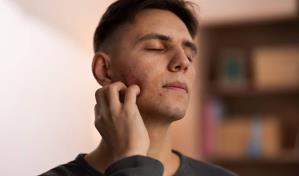 Día Mundial del Lupus: mitos que debemos dejar atrás sobre esta enfermedad