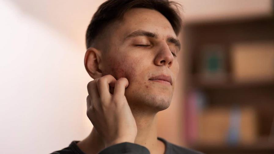 Día Mundial del Lupus: mitos que debemos dejar atrás sobre esta enfermedad Día Mundial del Lupus: mitos que debemos dejar atrás sobre esta enfermedad