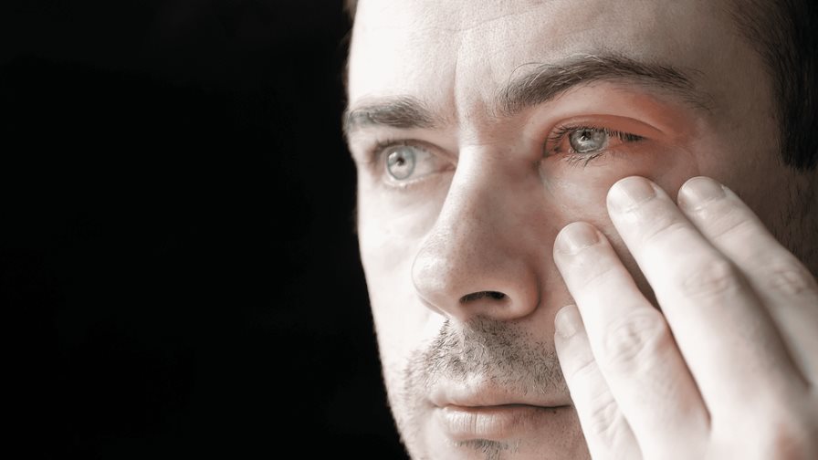 ¿Párpados hinchados e irritados? Podrías tener blefaritis ¿Párpados hinchados e irritados? Podrías tener blefaritis