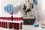 Una investigación española publicada en Nature revela cómo envejece la sangre humana Una investigación española publicada en Nature revela cómo envejece la sangre humana