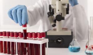 Una investigación española publicada en Nature revela cómo envejece la sangre humana