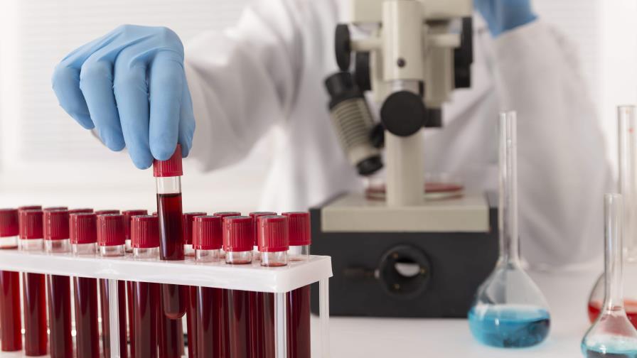 Una investigación española publicada en Nature revela cómo envejece la sangre humana Una investigación española publicada en Nature revela cómo envejece la sangre humana