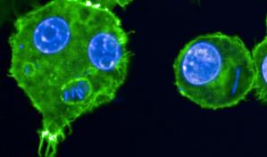 Descubren el gen que ha agravado las peores pandemias de peste de la historia