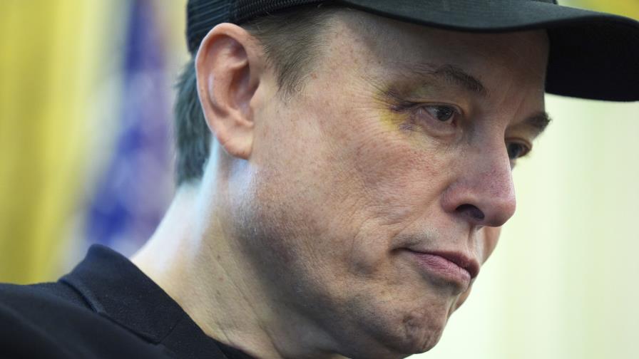 Musk luce un moretón en el ojo en su despedida y lo atribuye a un puñetazo de su hijo Musk luce un moretón en el ojo en su despedida y lo atribuye a un puñetazo de su hijo