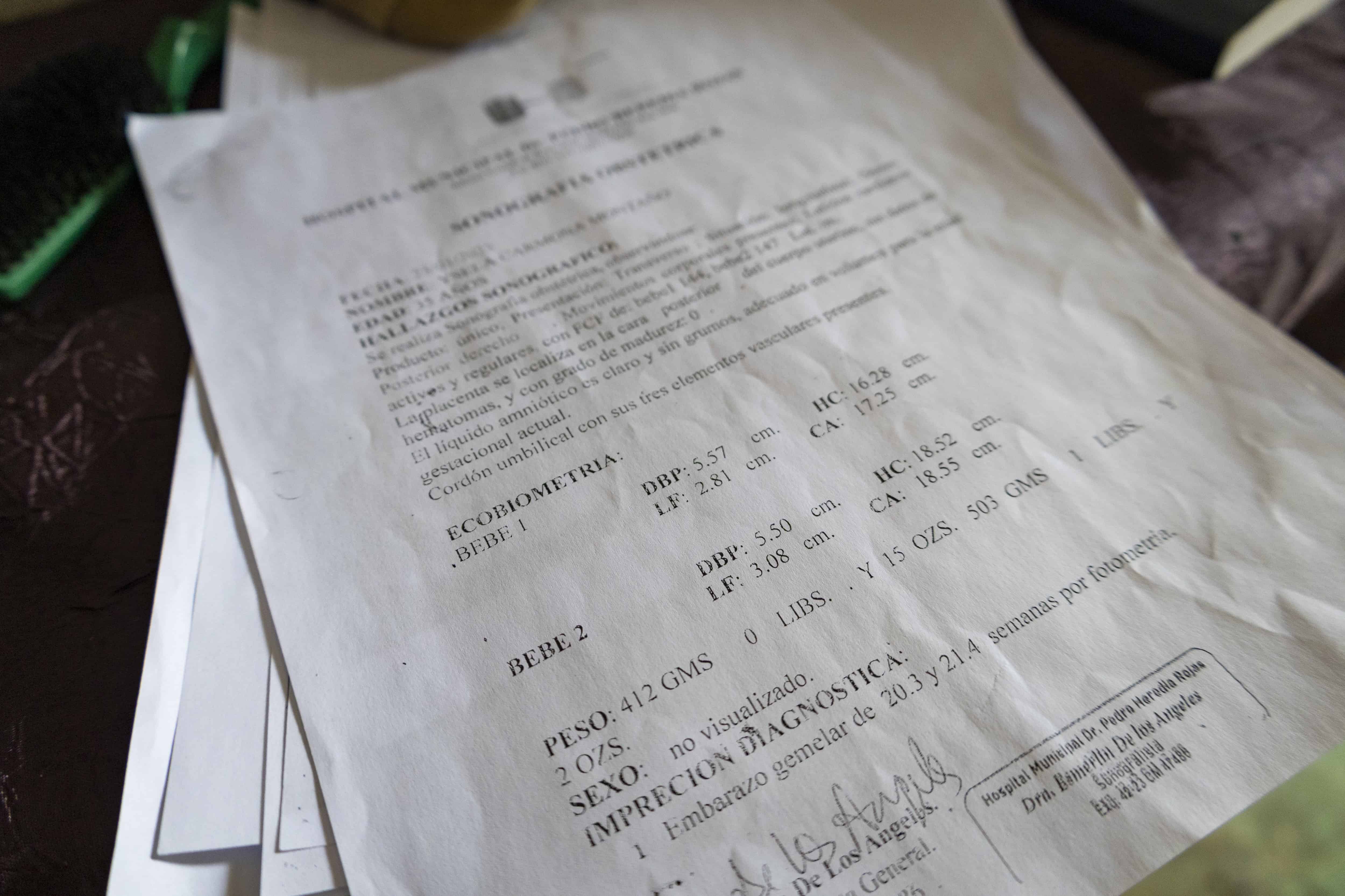 Reporte de una de las sonografías que le hicieron a Gisela Carmona que dice que tendría dos bebés. 