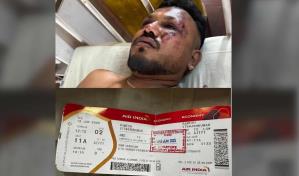 Vishwash Kumar Ramesh: el único que salió caminando del accidente aéreo en la India Vishwash Kumar Ramesh: el único que salió caminando del accidente aéreo en la India