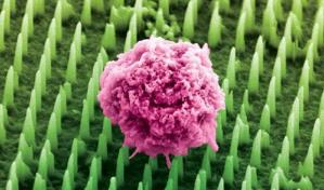 Decenas de millones de nanoagujas como alternativa a las dolorosas biopsias de cáncer Decenas de millones de nanoagujas como alternativa a las dolorosas biopsias de cáncer