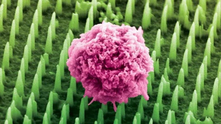 Decenas de millones de nanoagujas como alternativa a las dolorosas biopsias de cáncer