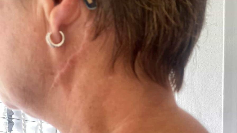 "Mi agresor vive al lado y anda como si nada", denuncia mujer que teme por su vida en Dajabón "Mi agresor vive al lado y anda como si nada", denuncia mujer que teme por su vida en Dajabón