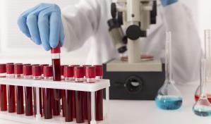 Análisis de sangre podría reemplazar a las muestras en médula ósea para detectar leucemia