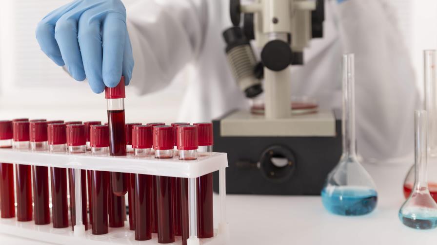 Análisis de sangre podría reemplazar a las muestras en médula ósea para detectar leucemia Análisis de sangre podría reemplazar a las muestras en médula ósea para detectar leucemia