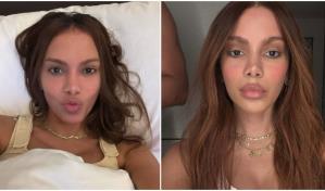 ¿Se operó? Anitta sorprende al aparecer con nuevo rostro