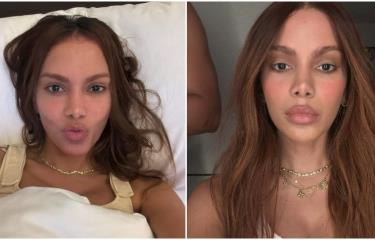 Anitta sorprende al reaparecer con nuevo rostro - Diario Libre