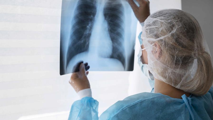 Sarcoma: El cáncer silencioso que ataca los tejidos y los huesos