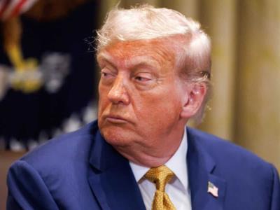 Donald Trump diagnosticado con insuficiencia venosa crónica
