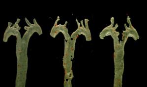 Una molécula generada por bacterias intestinales, nuevo factor clave de la aterosclerosis