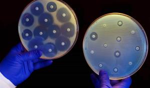 Confirman la extensión global de un gen que crea bacterias resistentes a los antibióticos Confirman la extensión global de un gen que crea bacterias resistentes a los antibióticos