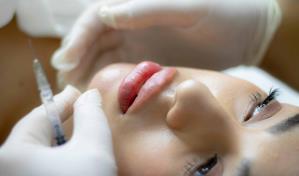 Aumento de labios: más natural, menos evidente Aumento de labios: más natural, menos evidente