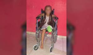 Reclaman justicia para niña embestida por motorista en Bayona