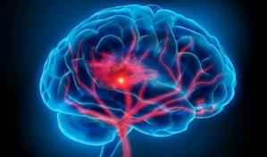 Los cerebros envejecieron más rápido en pandemia, incluso en las personas no infectadas Los cerebros envejecieron más rápido en pandemia, incluso en las personas no infectadas