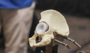 Farmaconal realiza Jornada de Artroplastia sobre el reemplazo articular de cadera