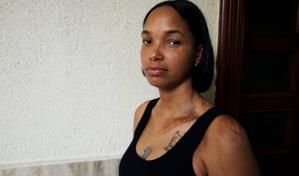 Me dijo que me la iba a hacer pagar: la historia de Yoselin, quemada viva por su expareja Me dijo que me la iba a hacer pagar: la historia de Yoselin, quemada viva por su expareja