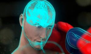 El impacto de la conmoción cerebral en deportes de contacto El impacto de la conmoción cerebral en deportes de contacto