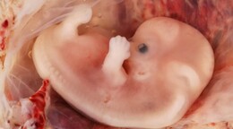 Cuatro a&ntilde;os despu&eacute;s, el fin de la protecci&oacute;n federal al aborto sigue impactando a EE. UU.