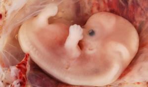 Las condiciones neuropsiquiátricas podrían gestarse desde el vientre de la madre