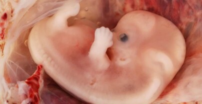 Massachusetts se convierte en el d&eacute;cimo estado en permitir abortos hasta el momento del nacimiento