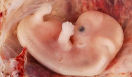 Massachusetts se convierte en el d&eacute;cimo estado en permitir abortos hasta el momento del nacimiento