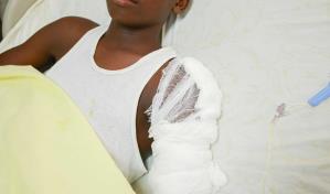 Caí al suelo y veía todo borroso, como en cámara lenta, relato del niño que sobrevivió a un rayo